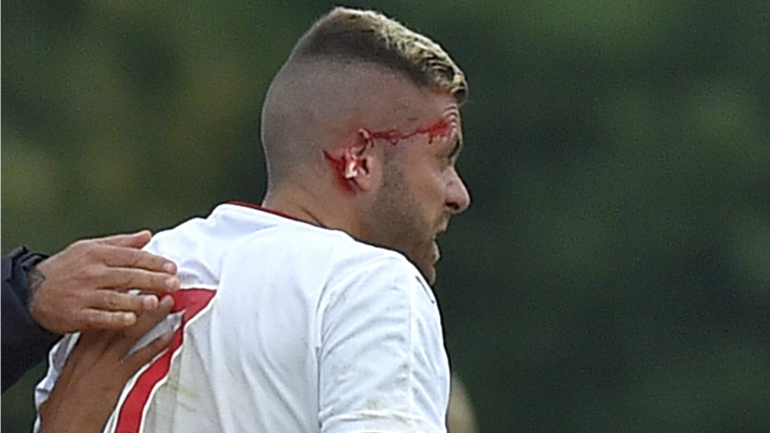 LOOK: Soccer player steps on opponent's head with metal cleat and rips his ear off