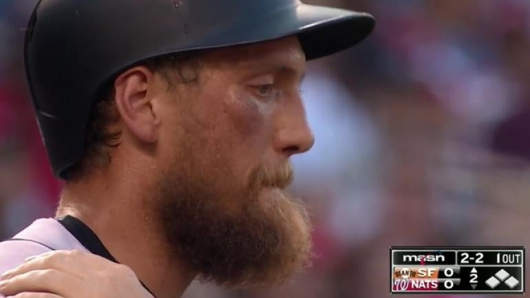 LOOK: Here's what Hunter Pence looks like after fouling a ball off his face