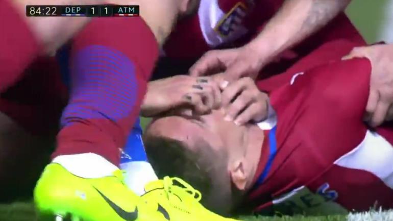 Atletico Madrid's Fernando Torres suffers 'traumatic brain injury' in collision