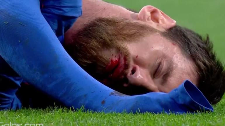El Clasico 2017: Messi bloodied after violent elbow to face in Barcelona vs. Real Madrid