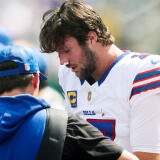 josh-allen-nose.jpg