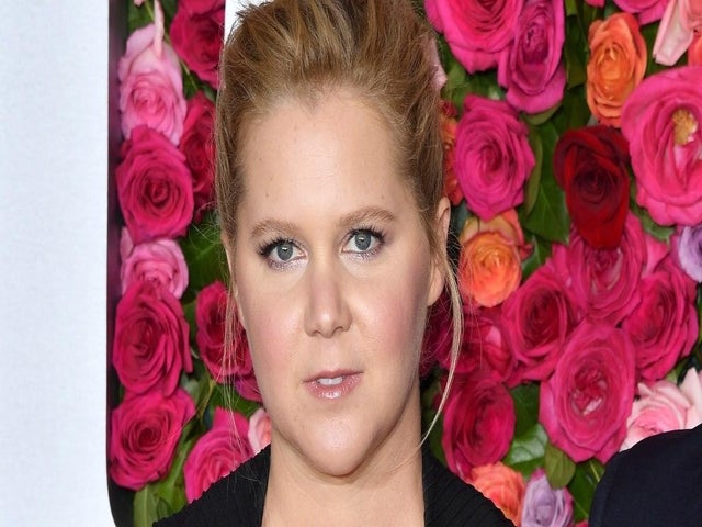 Amy Schumer Reveals She Underwent Plastic Surgery Procedure, Endometriosis Surgery