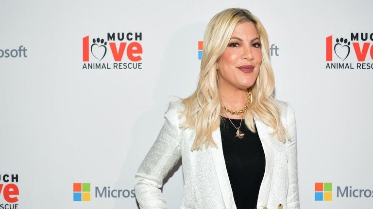 Tori Spelling Seen With Bruises on Her Face and Arm as She Leaves Hospital