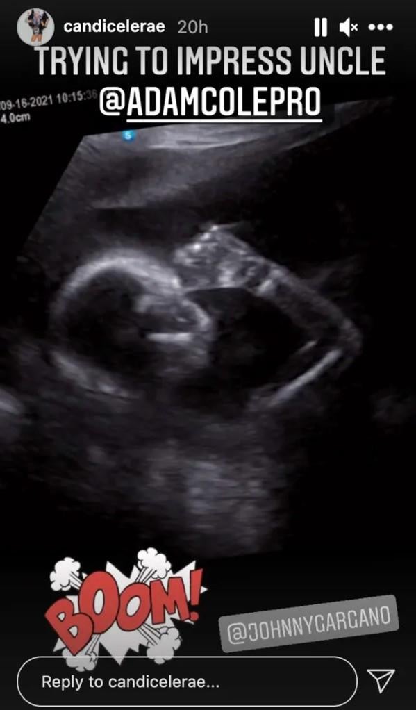 candice-lerae-baby-ultrasound.jpg