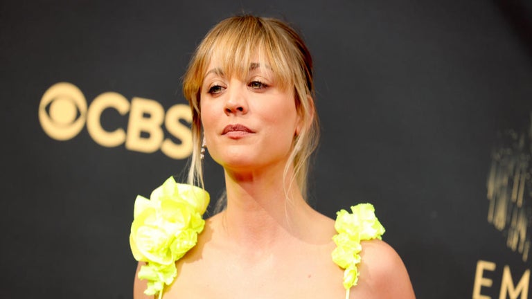 Kaley Cuoco Nearly Had to Amputate Her Leg Following Equestrian Accident