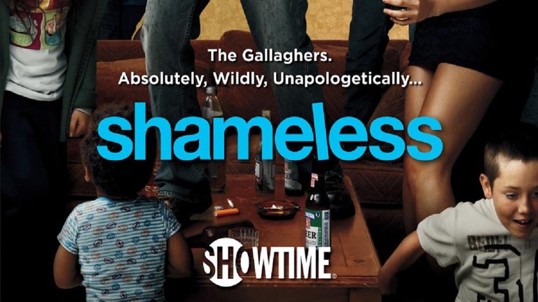 'Shameless' Actor Is Totally Unrecognizable in Recent Photos
