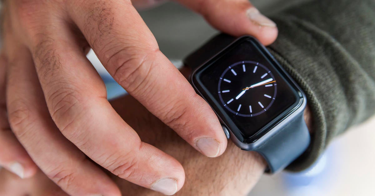 SmartWatch Recalled Over Fears of Causing Burns and Fires