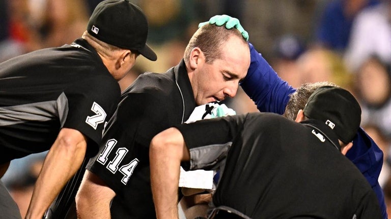 MLB Umpire Nearly Loses His Eye in Shattered Bat Accident
