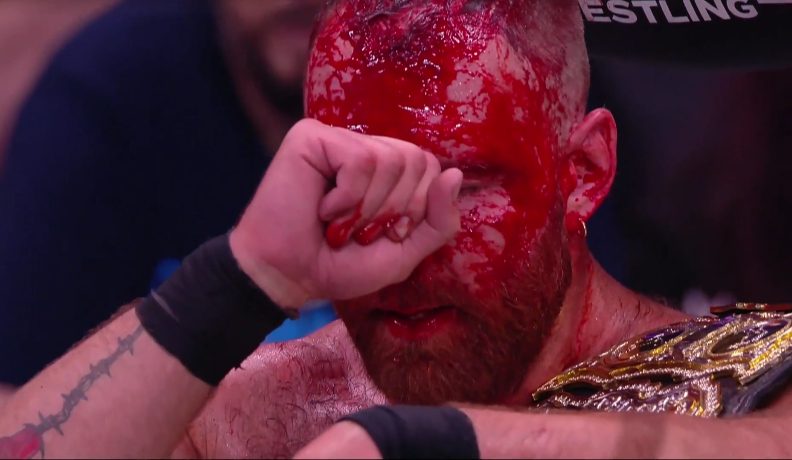 jon-moxley-aew-champion.png jon-moxley-aew-champion.png