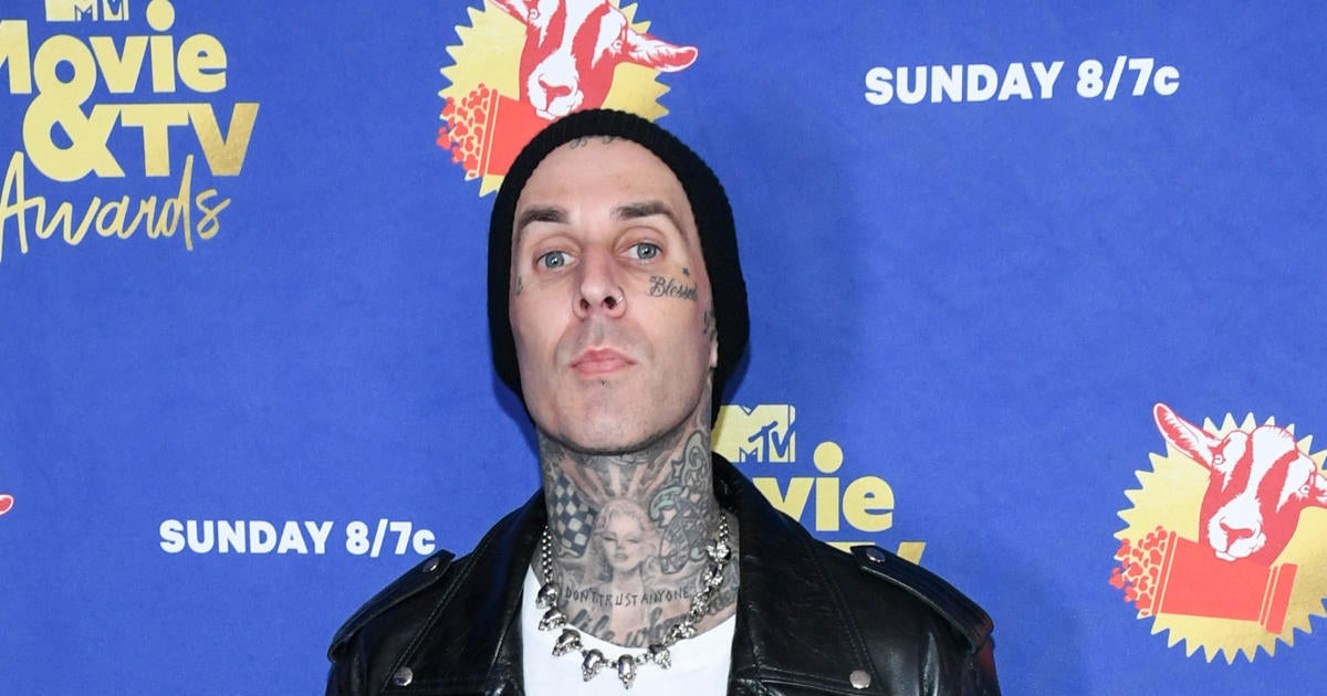 Blink-182’s Travis Barker Spotted With Brace Following Serious Injury