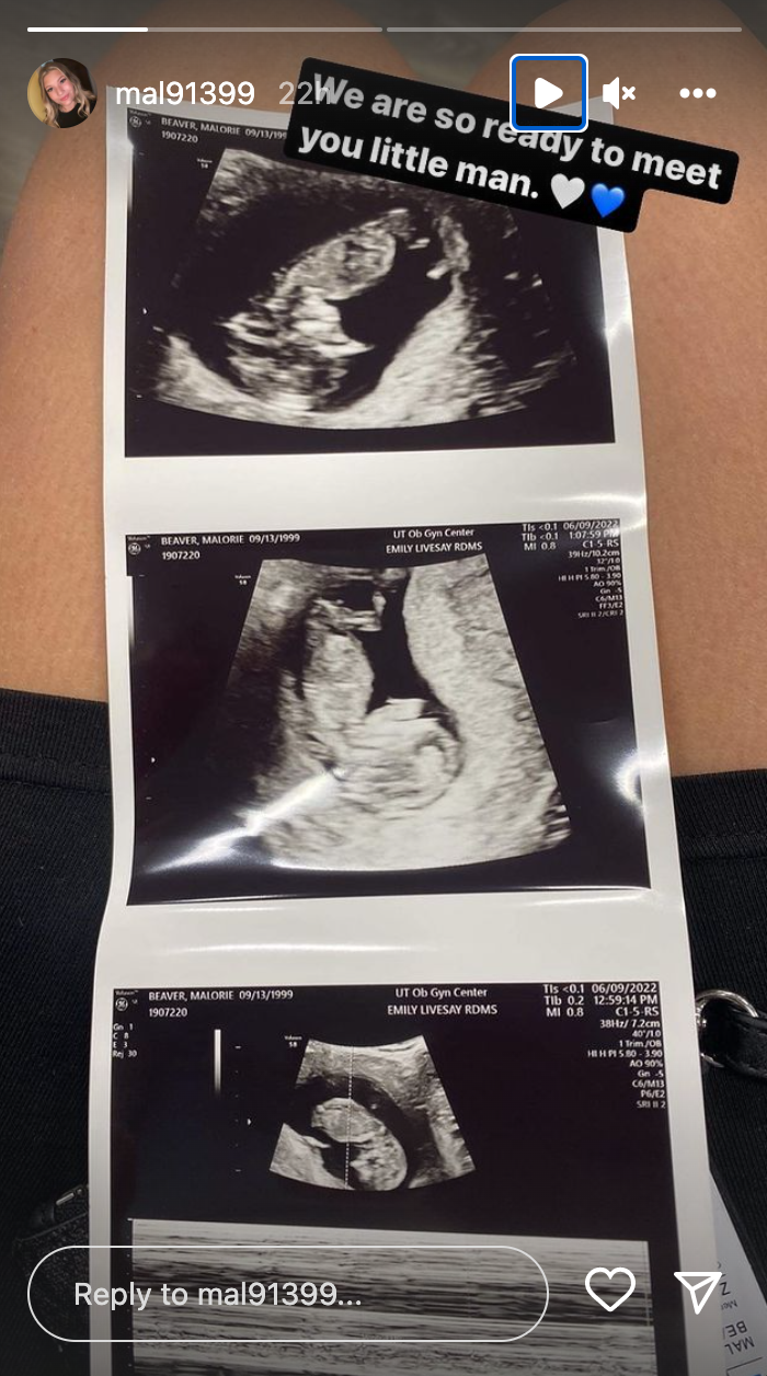 malorie-beaver-ultrasound.png malorie-beaver-ultrasound.png