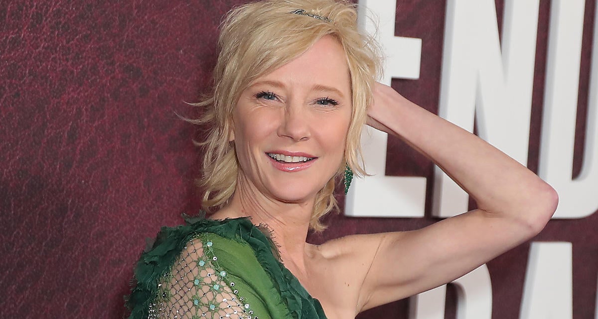 Anne Heche Has 'Long Recovery' From Severe Burns After Car Crash.jpg
