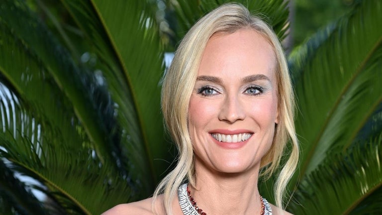 Diane Kruger Clears up Rumors After Posting Photo of Possible Injury
