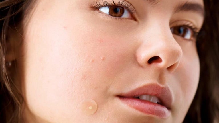 These $12 Pimple Patches from Amazon Made My Zits Vanish Overnight
