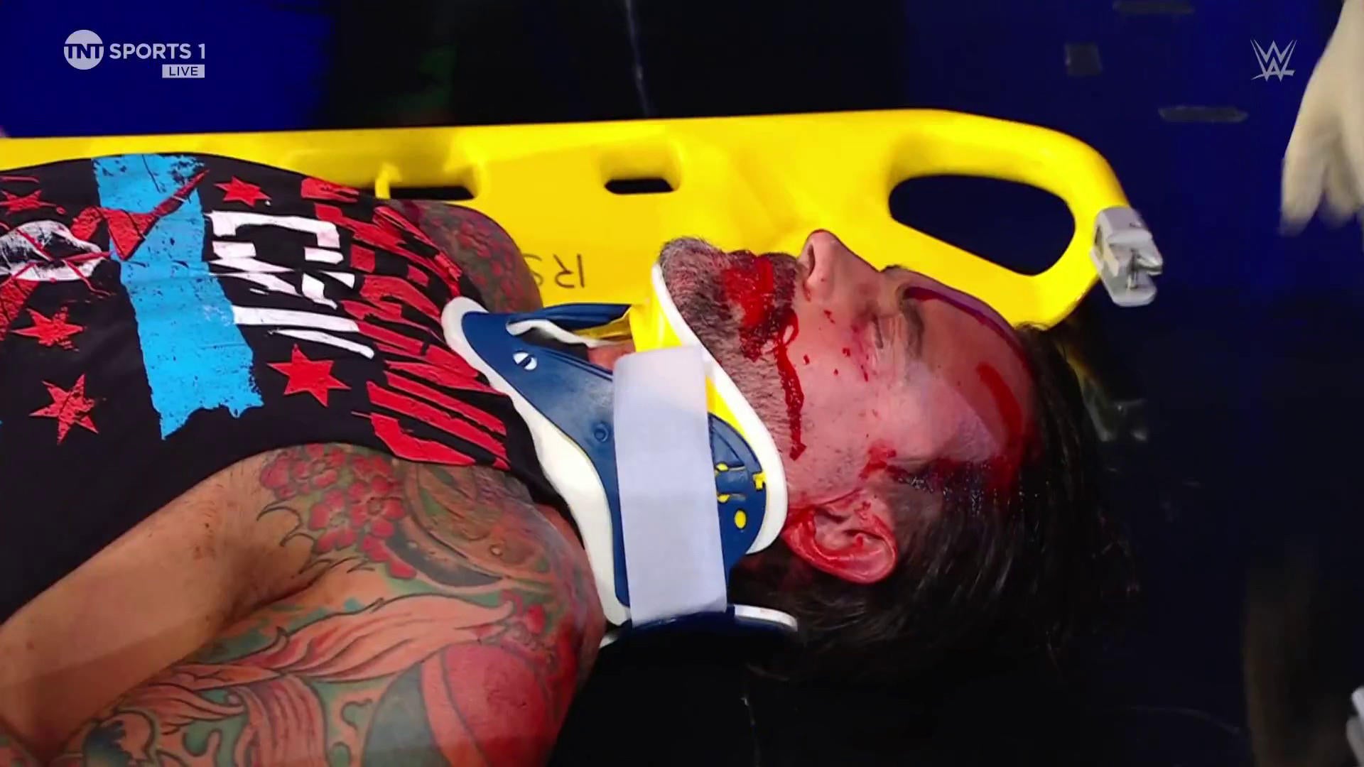 Дрю Макинтайр из WWE оставил CM Punk в крови после жестокого нападения на SmackDown