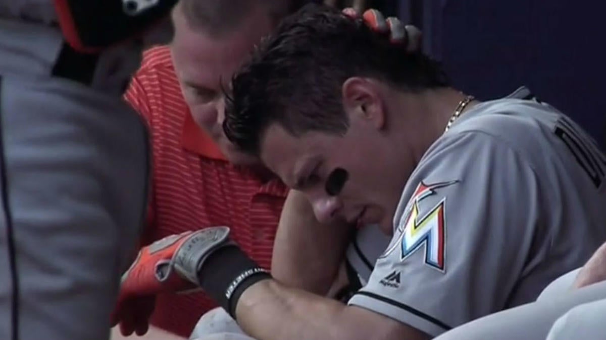 Derek Dietrich describes getting hit by foul ball