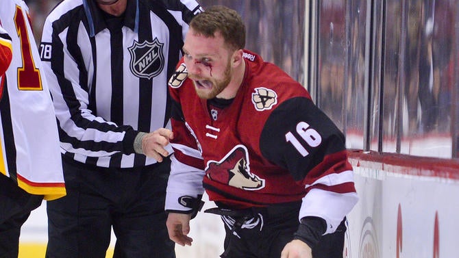 usatsi9733523max-domi-coyotes.jpg