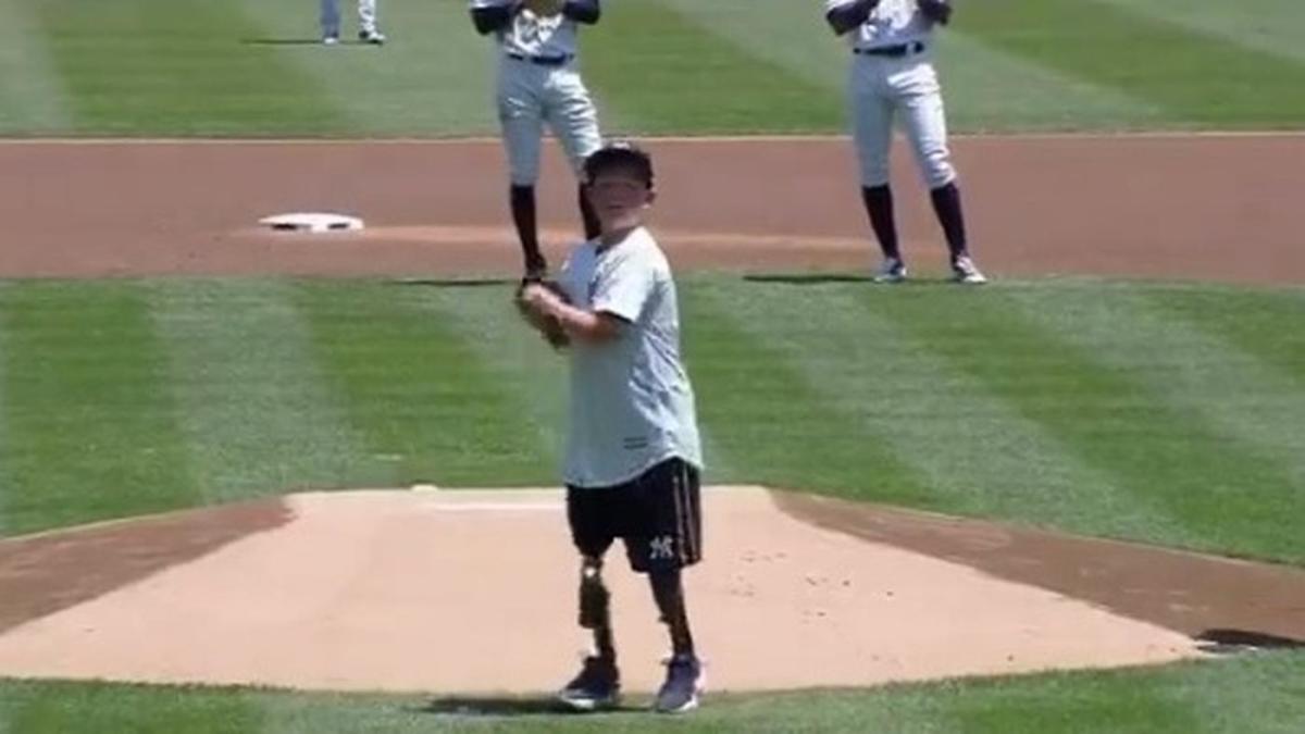 WATCH 11yearold born without hands and legs throws out Yankee