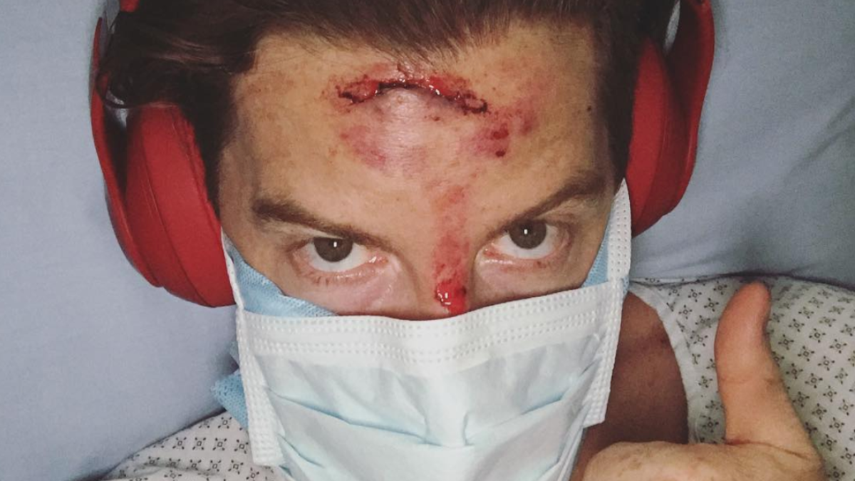 Details emerge about Shaun White&#039;s horrific slam that nearly cost him