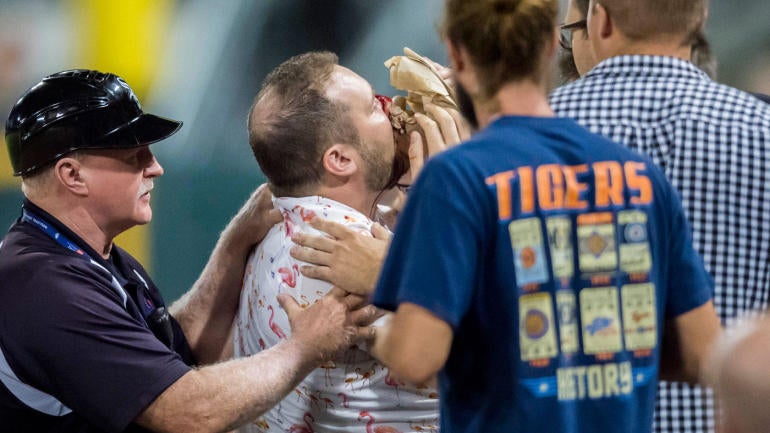 Fan Hit In Face By Foul Ball During White Sox Game, Taken To Chicago ...