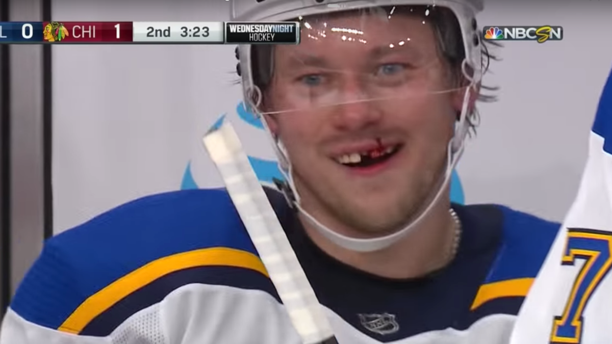 nhl teeth knocked out