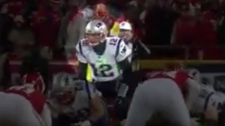 NFL investigating laser pointer used on Tom Brady right 