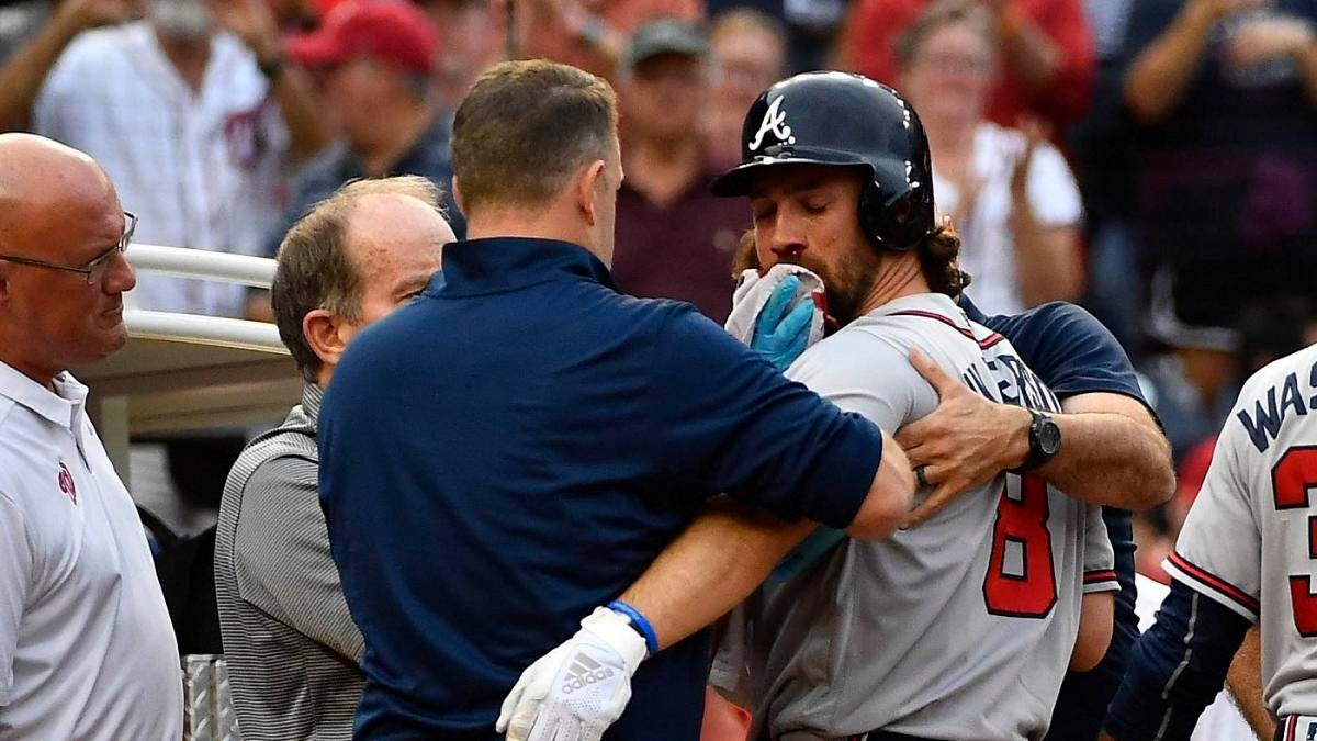 Braves' Charlie Culberson fractures facial bones after taking