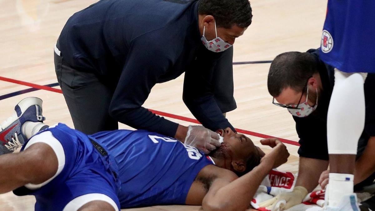 Kawhi Leonard Injury Clippers All Star Gets Eight Stitches To Treat Laceration In Mouth After Elbow To Face Cbssports Com