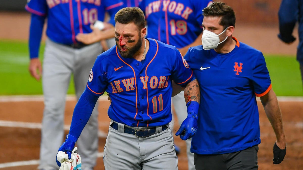 Mets’ Kevin Pillar suffers multiple fractures after getting hit in face with fastball vs. Braves