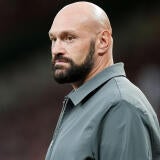 tyson-fury-head.jpg