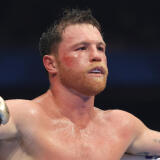 canelo-alvarez-boxing-cbs-sports-news-today-elbow-surgery-return-terence-crawford-bud